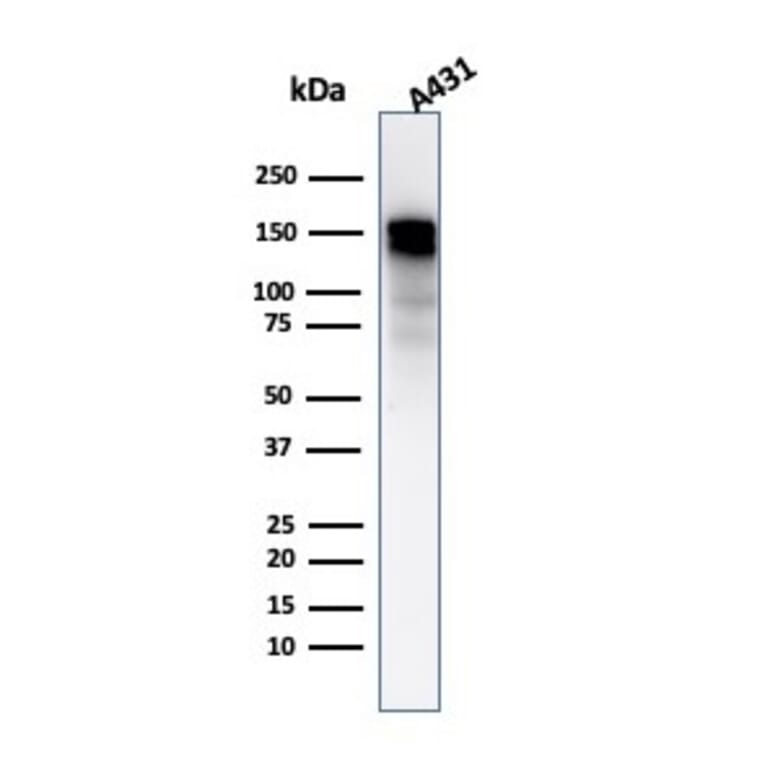 Western Blot - Anti-EGFR Antibody [GFR/2596] - BSA and Azide free (A251577) - Antibodies.com