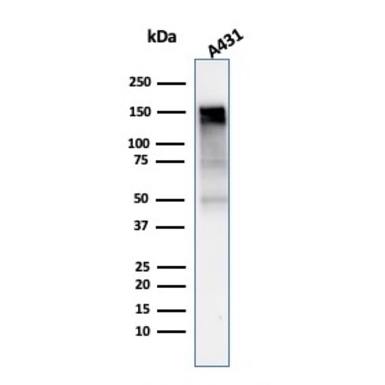 Western Blot - Anti-EGFR Antibody [rGFR/1667] - BSA and Azide free (A251579) - Antibodies.com