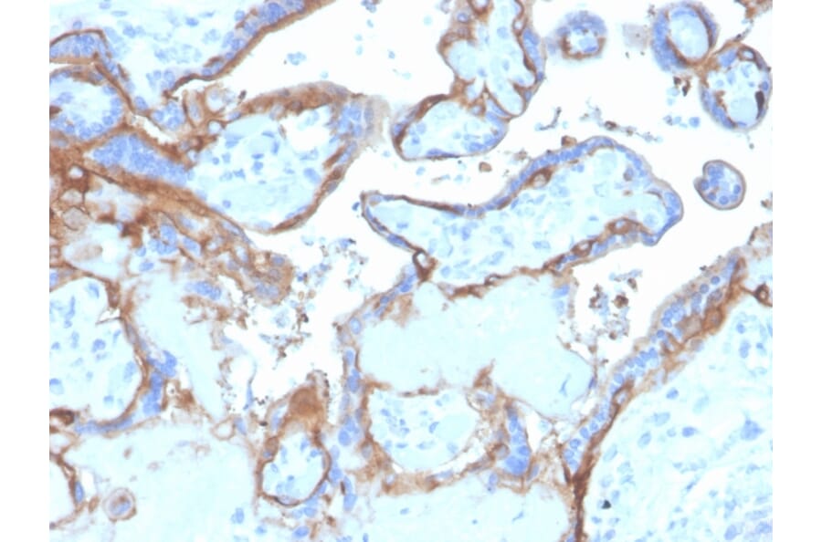Immunohistochemistry - Anti-EGFR Antibody [EGFR/4575] - BSA and Azide free (A251581) - Antibodies.com