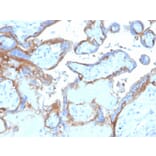Immunohistochemistry - Anti-EGFR Antibody [EGFR/4575] - BSA and Azide free (A251581) - Antibodies.com