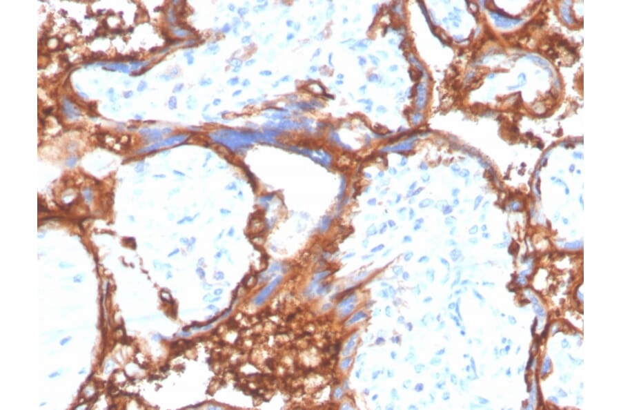 Immunohistochemistry - Anti-EGFR Antibody [EGFR/4575] - BSA and Azide free (A248399) - Antibodies.com