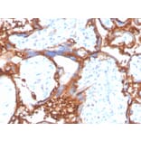 Immunohistochemistry - Anti-EGFR Antibody [EGFR/4575] - BSA and Azide free (A248399) - Antibodies.com