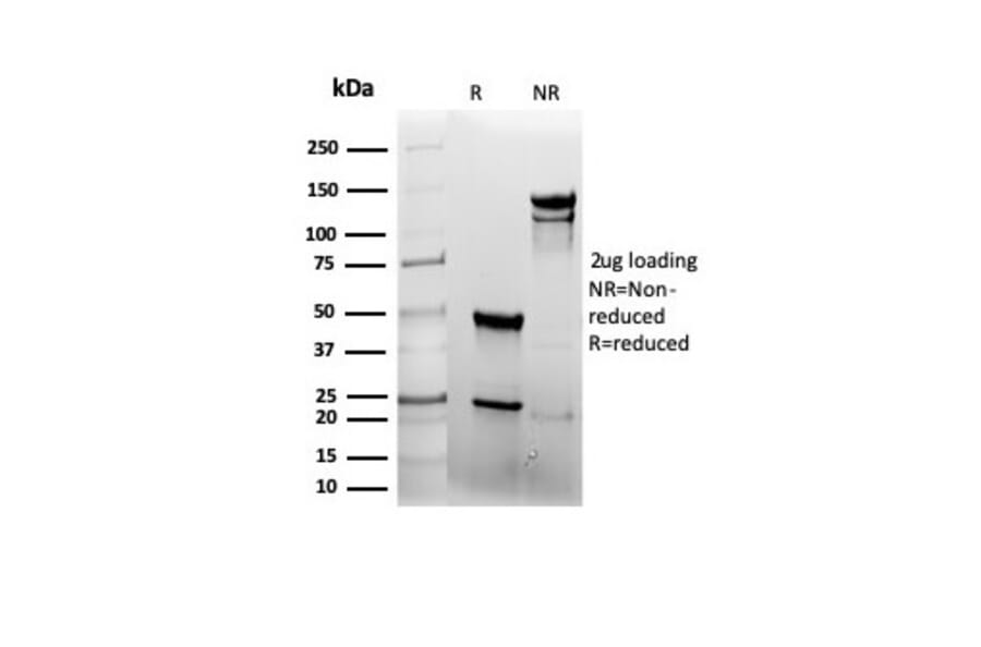 SDS-PAGE - Anti-EGFR Antibody [rEGFR/6389] - BSA and Azide free (A251582) - Antibodies.com