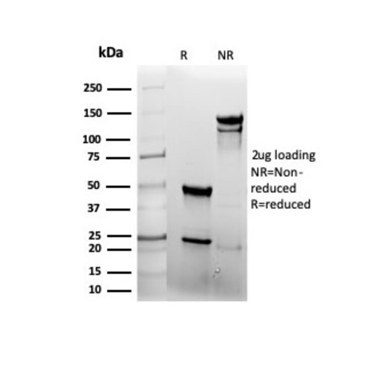 SDS-PAGE - Anti-EGFR Antibody [rEGFR/6389] - BSA and Azide free (A251582) - Antibodies.com