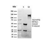 SDS-PAGE - Anti-EGFR Antibody [rEGFR/6389] - BSA and Azide free (A251582) - Antibodies.com