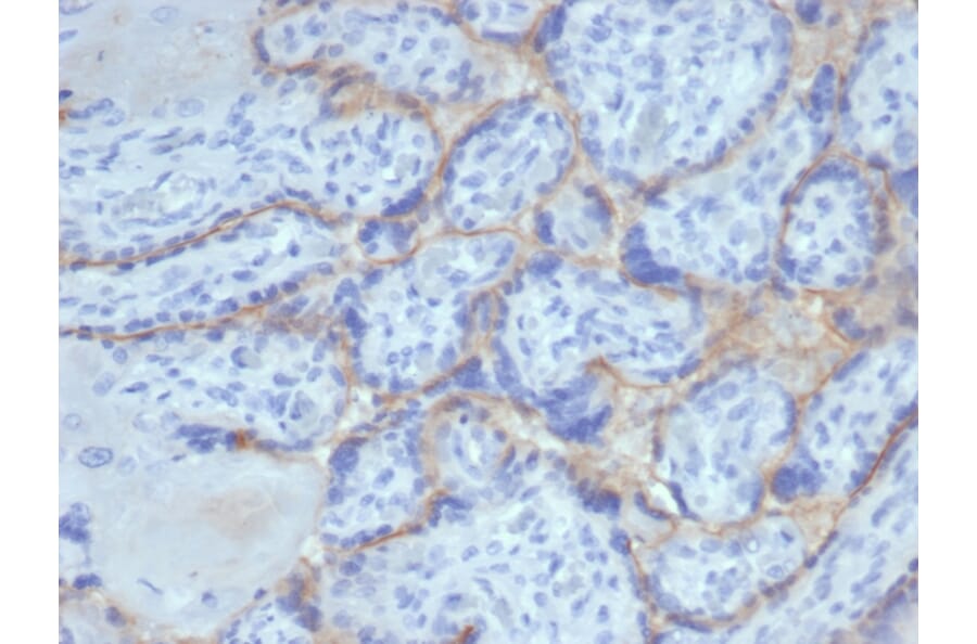 Immunohistochemistry - Anti-EGFR Antibody [rEGFR/6389] - BSA and Azide free (A251581) - Antibodies.com