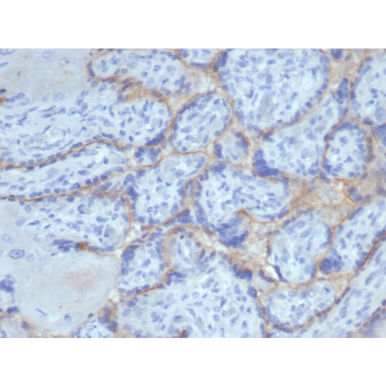 Immunohistochemistry - Anti-EGFR Antibody [rEGFR/6389] - BSA and Azide free (A251581) - Antibodies.com