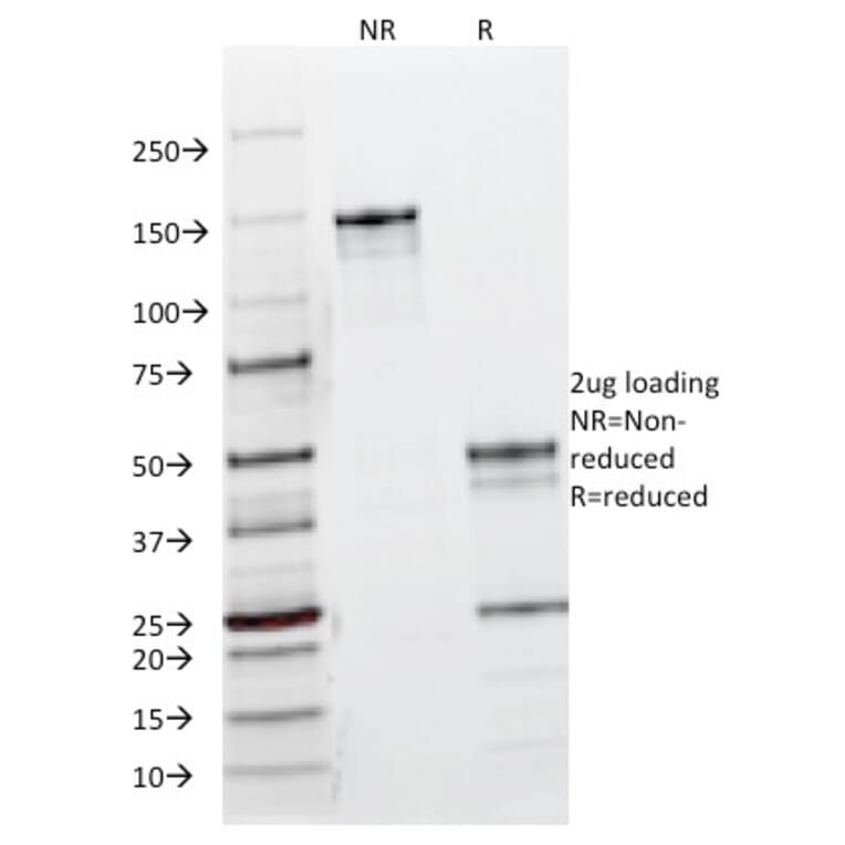 SDS-PAGE - Anti-EGFR Antibody [B1D8] - BSA and Azide free (A251582) - Antibodies.com