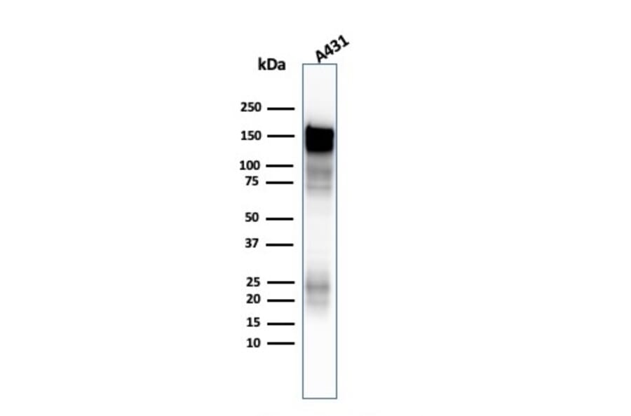 Western Blot - Anti-EGFR Antibody [H9B4] - BSA and Azide free (A251584) - Antibodies.com