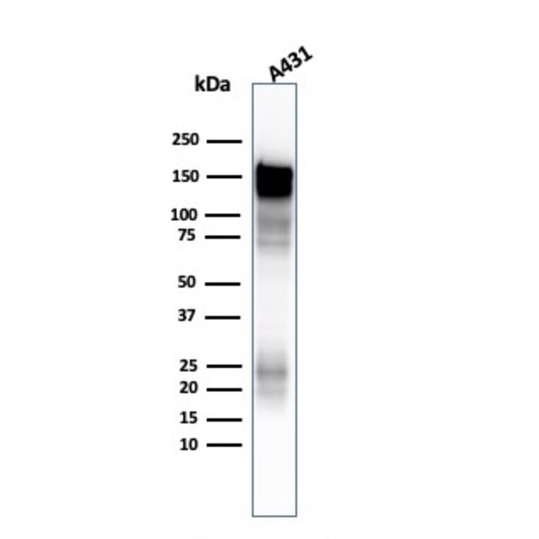Western Blot - Anti-EGFR Antibody [H9B4] - BSA and Azide free (A251584) - Antibodies.com
