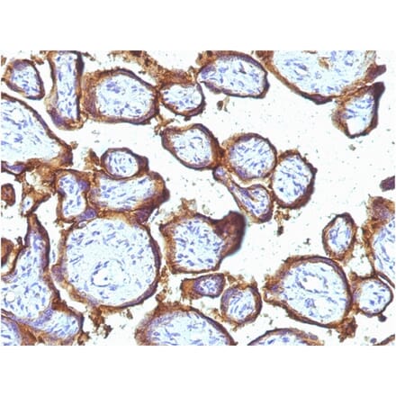 Immunohistochemistry - Anti-EGFR Antibody [31G7] - BSA and Azide free (A251585) - Antibodies.com