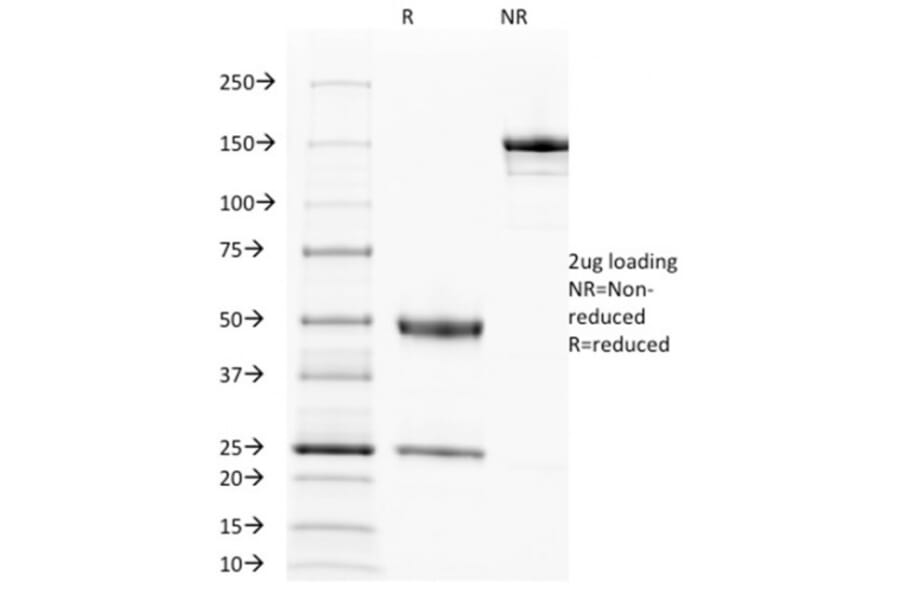 SDS-PAGE - Anti-EGFR Antibody [31G7] - BSA and Azide free (A251585) - Antibodies.com