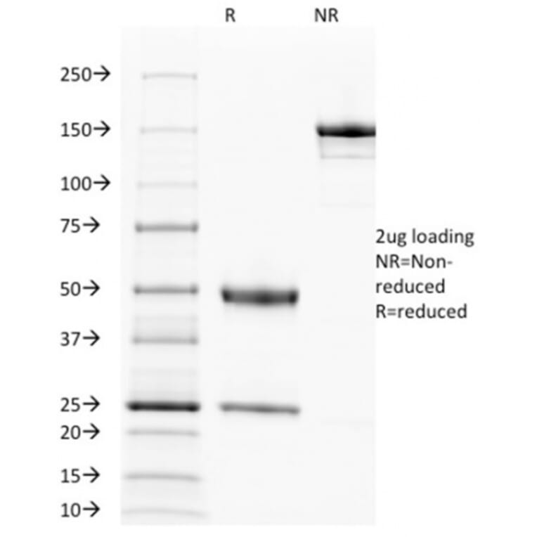 SDS-PAGE - Anti-EGFR Antibody [31G7] - BSA and Azide free (A251585) - Antibodies.com