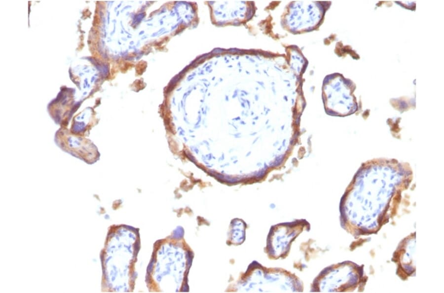 Immunohistochemistry - Anti-EGFR Antibody [GFR1195] - BSA and Azide free (A248405) - Antibodies.com