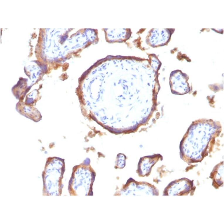 Immunohistochemistry - Anti-EGFR Antibody [GFR1195] - BSA and Azide free (A248405) - Antibodies.com