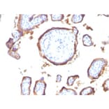 Immunohistochemistry - Anti-EGFR Antibody [GFR1195] - BSA and Azide free (A248405) - Antibodies.com