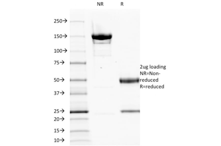SDS-PAGE - Anti-EGFR Antibody [GFR1195] - BSA and Azide free (A248405) - Antibodies.com