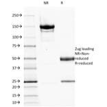 SDS-PAGE - Anti-EGFR Antibody [GFR1195] - BSA and Azide free (A248405) - Antibodies.com