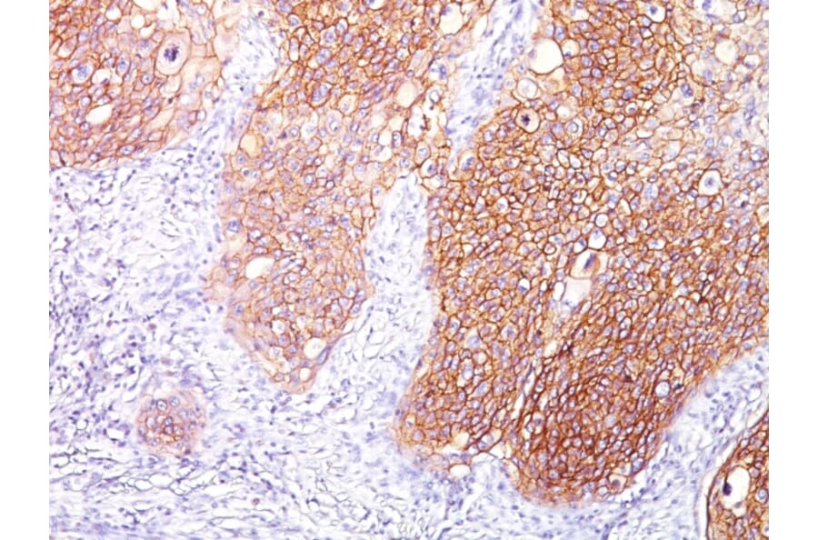 Immunohistochemistry - Anti-EGFR Antibody [GFR/1667] - BSA and Azide free (A251589) - Antibodies.com