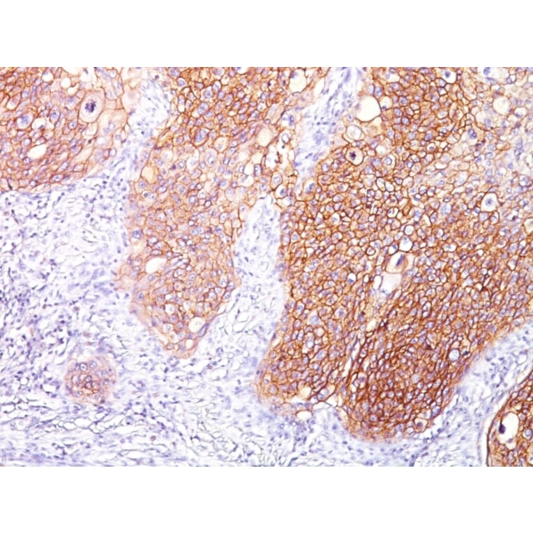 Immunohistochemistry - Anti-EGFR Antibody [GFR/1667] - BSA and Azide free (A251589) - Antibodies.com