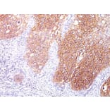 Immunohistochemistry - Anti-EGFR Antibody [GFR/1667] - BSA and Azide free (A251589) - Antibodies.com
