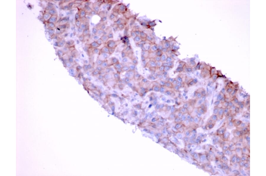 Immunohistochemistry - Anti-EGFR Antibody [GFR/1667] - BSA and Azide free (A251588) - Antibodies.com