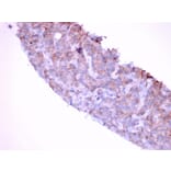 Immunohistochemistry - Anti-EGFR Antibody [GFR/1667] - BSA and Azide free (A251588) - Antibodies.com