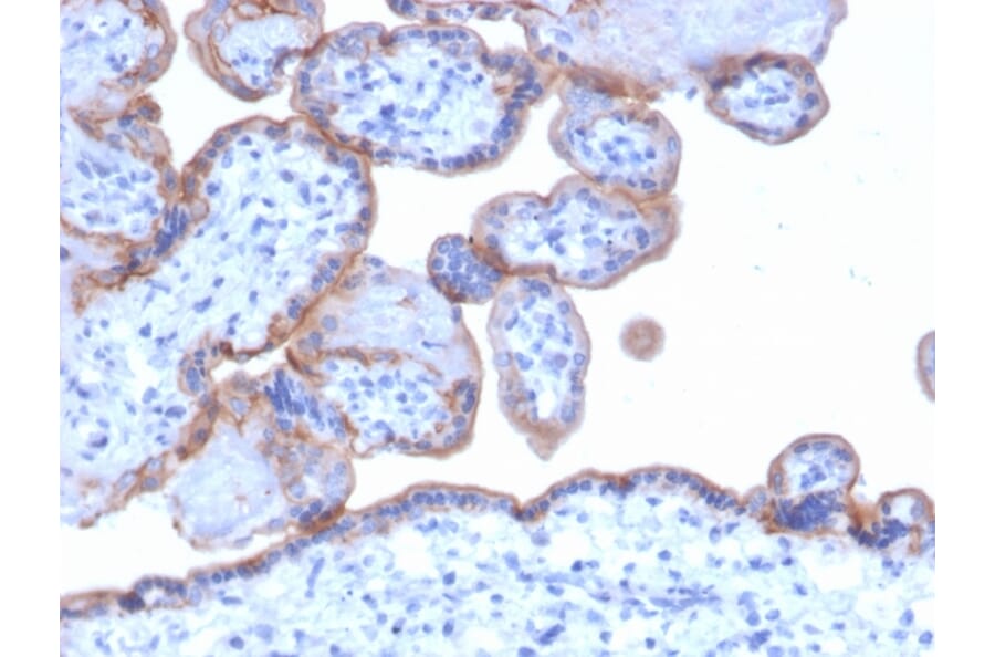Immunohistochemistry - Anti-EGFR Antibody [GFR/1667] - BSA and Azide free (A251589) - Antibodies.com