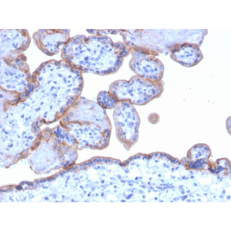 Immunohistochemistry - Anti-EGFR Antibody [GFR/1667] - BSA and Azide free (A251589) - Antibodies.com