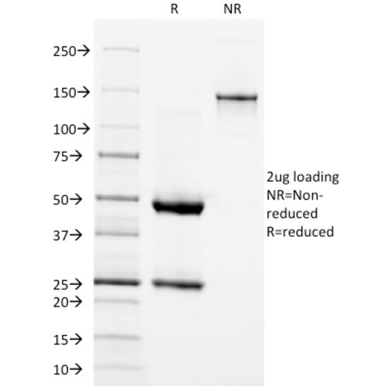 SDS-PAGE - Anti-EGFR Antibody [GFR/1667] - BSA and Azide free (A251589) - Antibodies.com