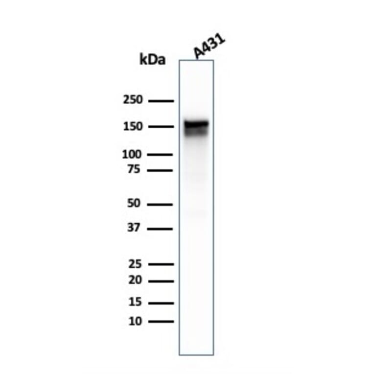 Western Blot - Anti-EGFR Antibody [GFR/1667] - BSA and Azide free (A251589) - Antibodies.com