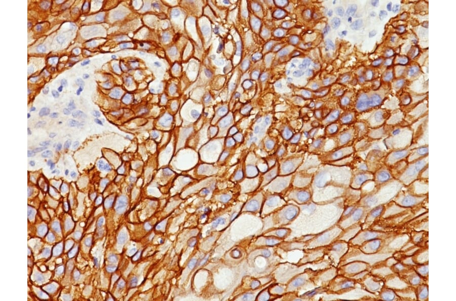 Immunohistochemistry - Anti-EGFR Antibody [GFR/1708] - BSA and Azide free (A251589) - Antibodies.com