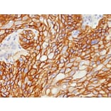 Immunohistochemistry - Anti-EGFR Antibody [GFR/1708] - BSA and Azide free (A251589) - Antibodies.com