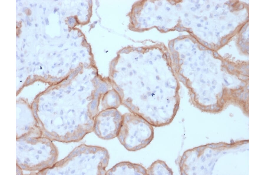 Immunohistochemistry - Anti-EGFR Antibody [GFR/1708] - BSA and Azide free (A251590) - Antibodies.com