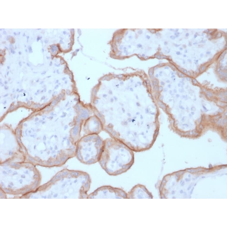 Immunohistochemistry - Anti-EGFR Antibody [GFR/1708] - BSA and Azide free (A251590) - Antibodies.com