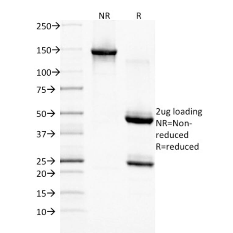 SDS-PAGE - Anti-EGFR Antibody [GFR/1708] - BSA and Azide free (A251590) - Antibodies.com