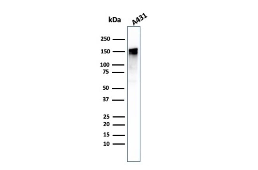 Western Blot - Anti-EGFR Antibody [GFR/1708] - BSA and Azide free (A251590) - Antibodies.com
