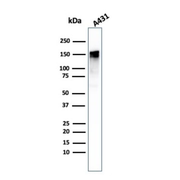Western Blot - Anti-EGFR Antibody [GFR/1708] - BSA and Azide free (A251590) - Antibodies.com