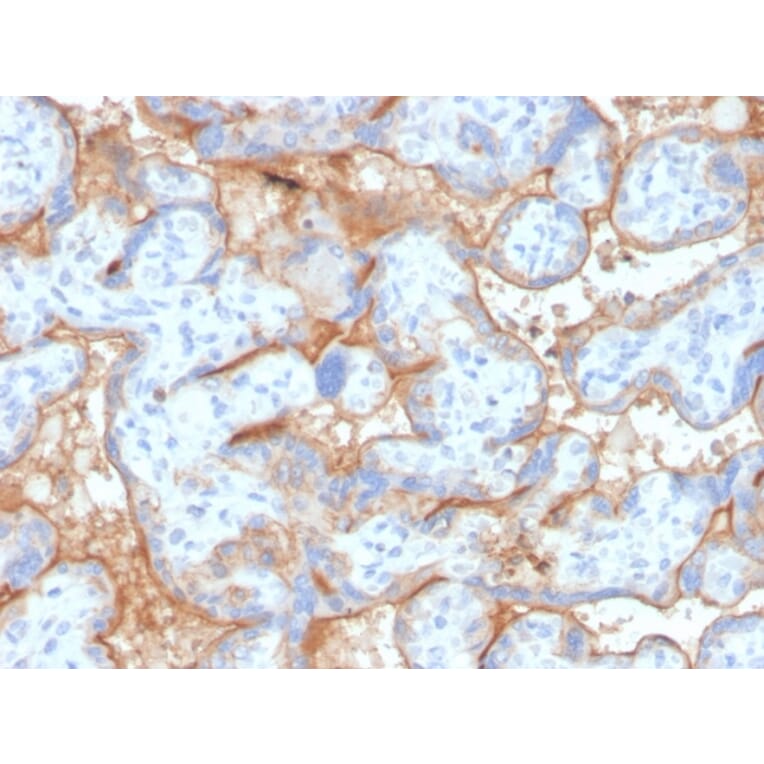 Immunohistochemistry - Anti-EGFR Antibody [GFR/4563R] - BSA and Azide free (A251592) - Antibodies.com