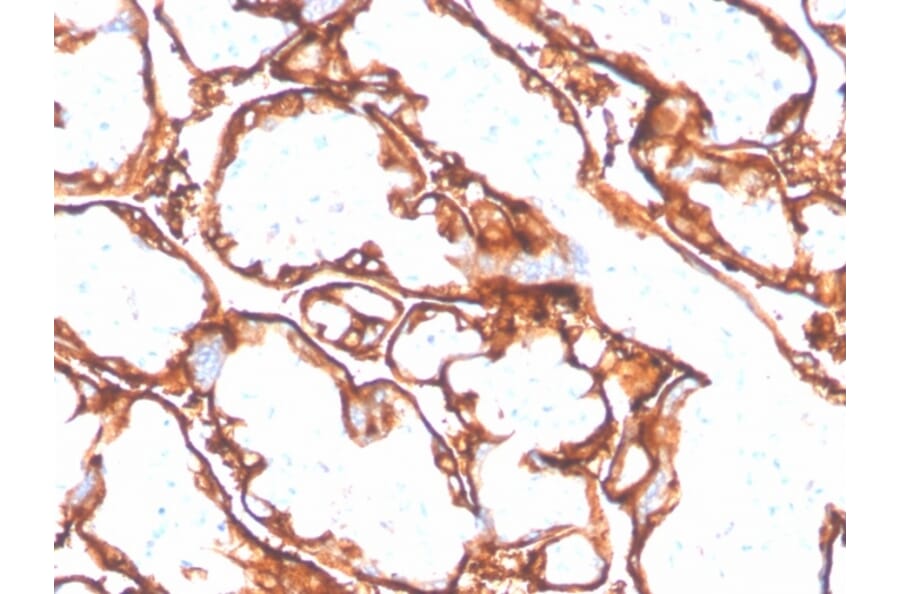 Immunohistochemistry - Anti-EGFR (mutated L858R) Antibody [GFR/4564R] - BSA and Azide free (A251594) - Antibodies.com