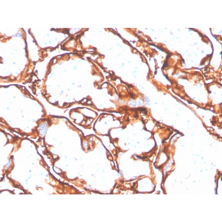 Immunohistochemistry - Anti-EGFR (mutated L858R) Antibody [GFR/4564R] - BSA and Azide free (A251594) - Antibodies.com