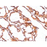 Immunohistochemistry - Anti-EGFR (mutated L858R) Antibody [GFR/4564R] - BSA and Azide free (A251594) - Antibodies.com