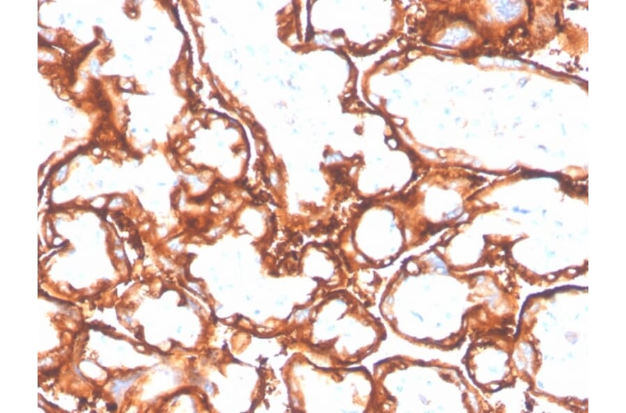 Immunohistochemistry - Anti-EGFR (mutated L858R) Antibody [GFR/4564R] - BSA and Azide free (A251593) - Antibodies.com