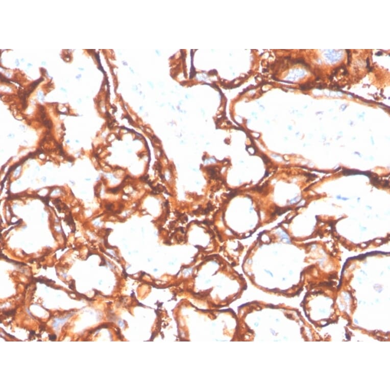 Immunohistochemistry - Anti-EGFR (mutated L858R) Antibody [GFR/4564R] - BSA and Azide free (A251593) - Antibodies.com