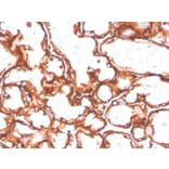 Immunohistochemistry - Anti-EGFR (mutated L858R) Antibody [GFR/4564R] - BSA and Azide free (A251593) - Antibodies.com