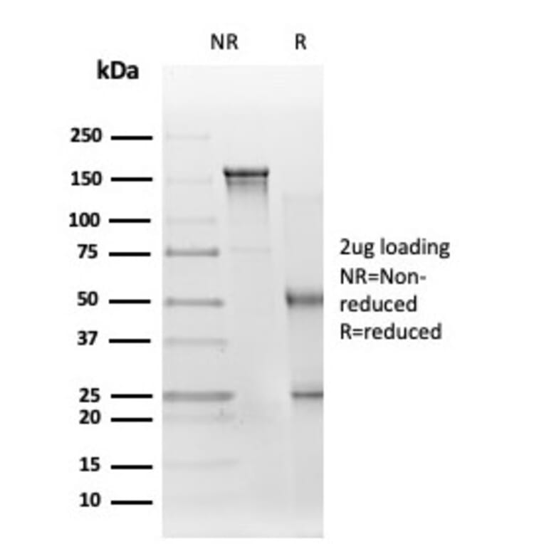 SDS-PAGE - Anti-EIF2S1 Antibody [PCRP-EIF2S1-1C11] - BSA and Azide free (A251595) - Antibodies.com