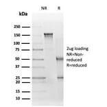 SDS-PAGE - Anti-EIF2S1 Antibody [PCRP-EIF2S1-1C11] - BSA and Azide free (A251595) - Antibodies.com