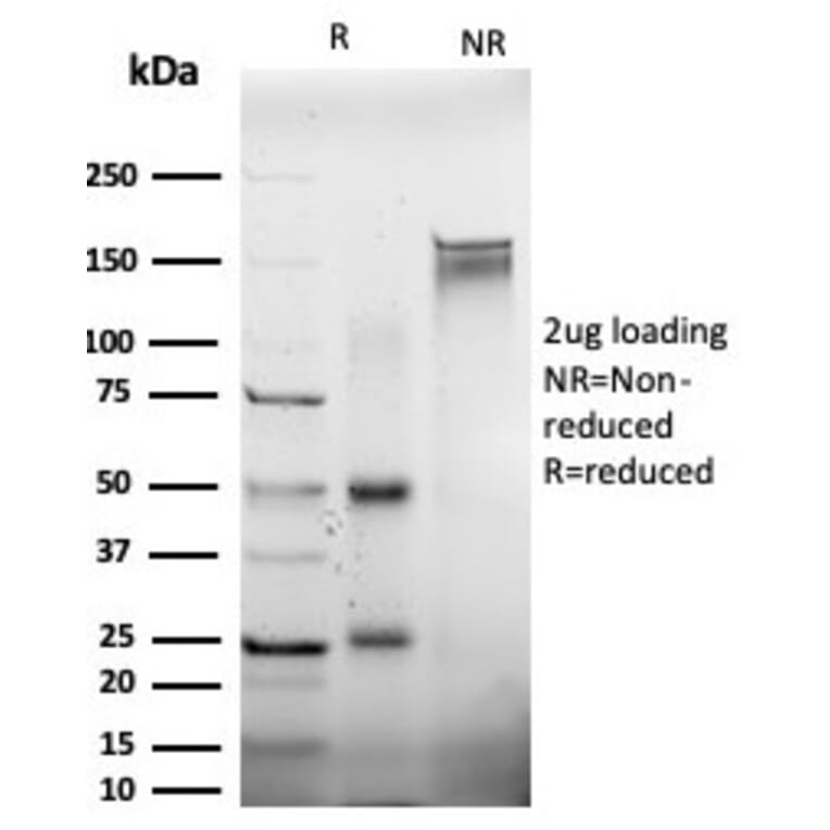 SDS-PAGE - Anti-EIF2S1 Antibody [PCRP-EIF2S1-1E2] - BSA and Azide free (A251596) - Antibodies.com