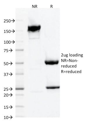 Anti-Iba1 Antibody [AIF1/1909] (A251599) | Antibodies.com