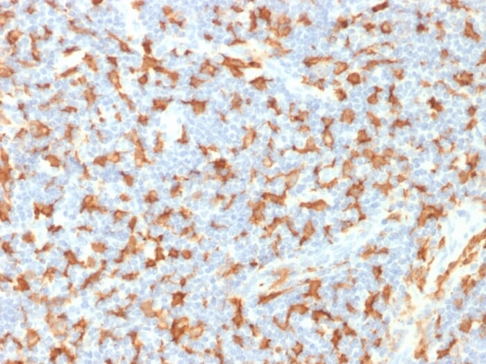 Anti-Iba1 Antibody [AIF1/1909] (A251599) | Antibodies.com